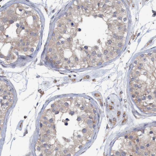 Monoacylglycerol Lipase Antibody in Immunohistochemistry (IHC)