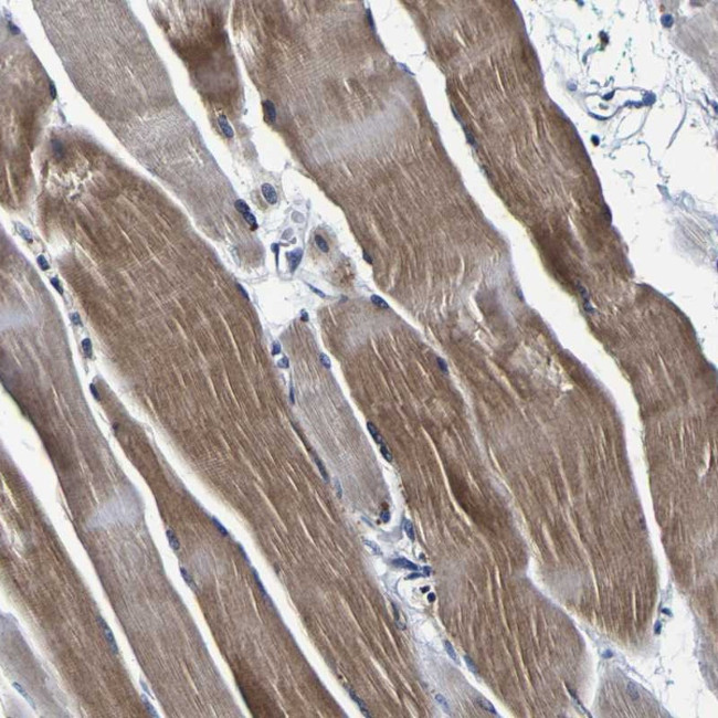 PANK4 Antibody in Immunohistochemistry (Paraffin) (IHC (P))