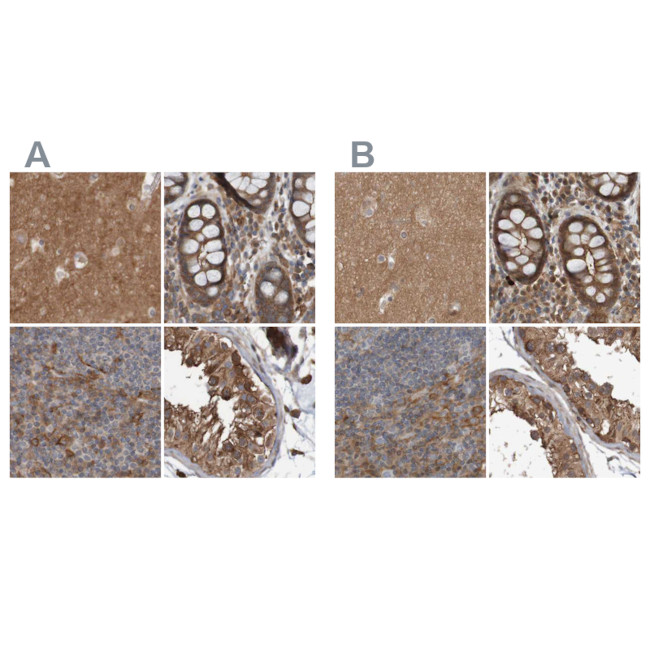 ARHGEF11 Antibody in Immunohistochemistry (IHC)