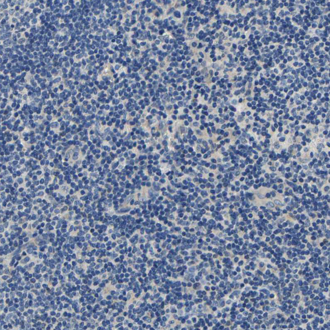 Centaurin alpha-1 Antibody in Immunohistochemistry (Paraffin) (IHC (P))