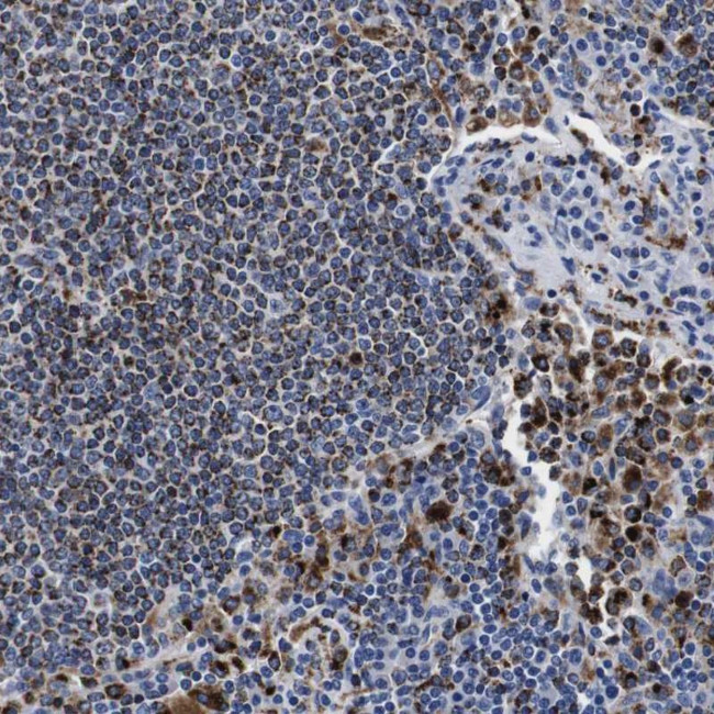HLA-DMB Antibody in Immunohistochemistry (Paraffin) (IHC (P))