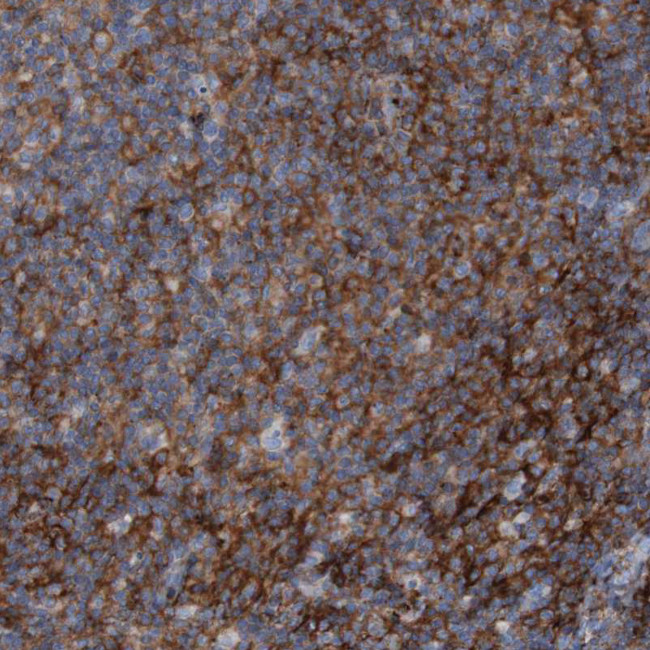 RNF182 Antibody in Immunohistochemistry (Paraffin) (IHC (P))