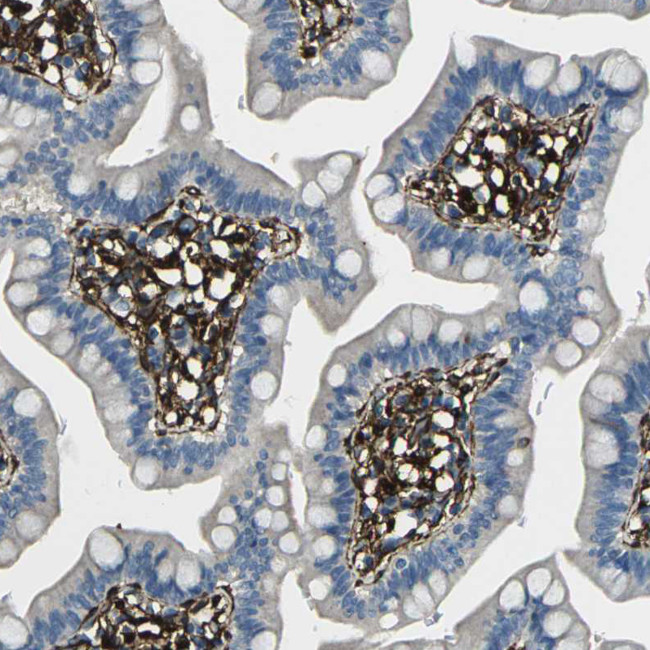 GRAMD1C Antibody in Immunohistochemistry (IHC)
