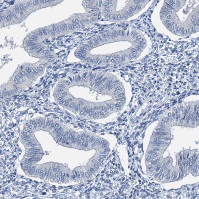 PP11 Antibody in Immunohistochemistry (Paraffin) (IHC (P))