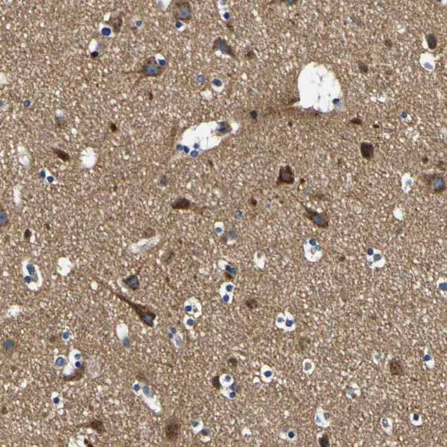 CLSTN1 Antibody in Immunohistochemistry (Paraffin) (IHC (P))