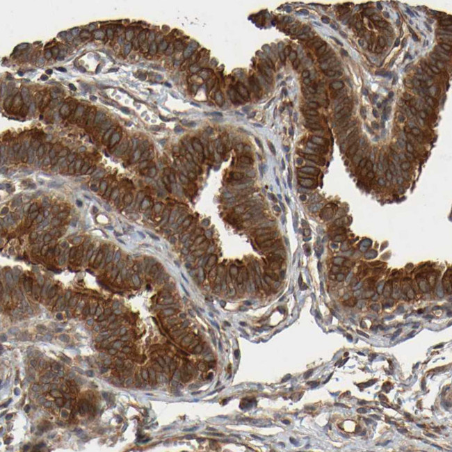 OCRL Antibody in Immunohistochemistry (Paraffin) (IHC (P))