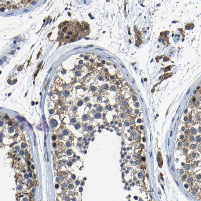 C6orf89 Antibody in Immunohistochemistry (Paraffin) (IHC (P))