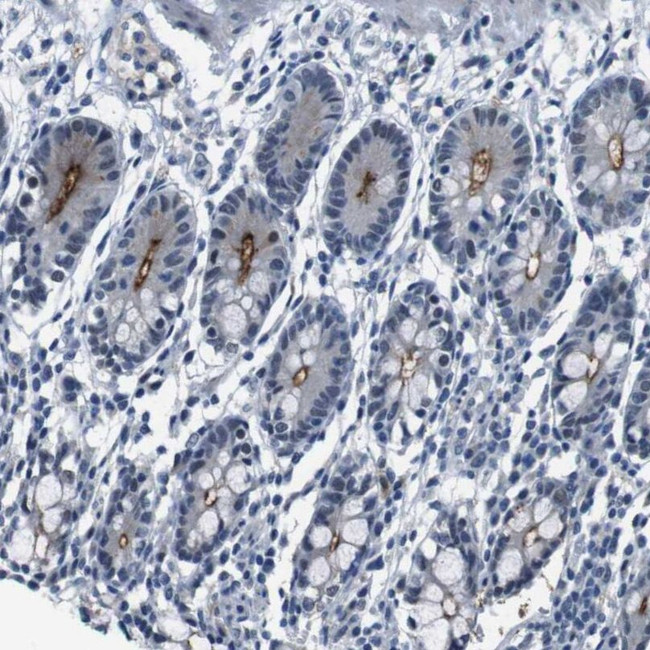 CDHR2 Antibody in Immunohistochemistry (IHC)