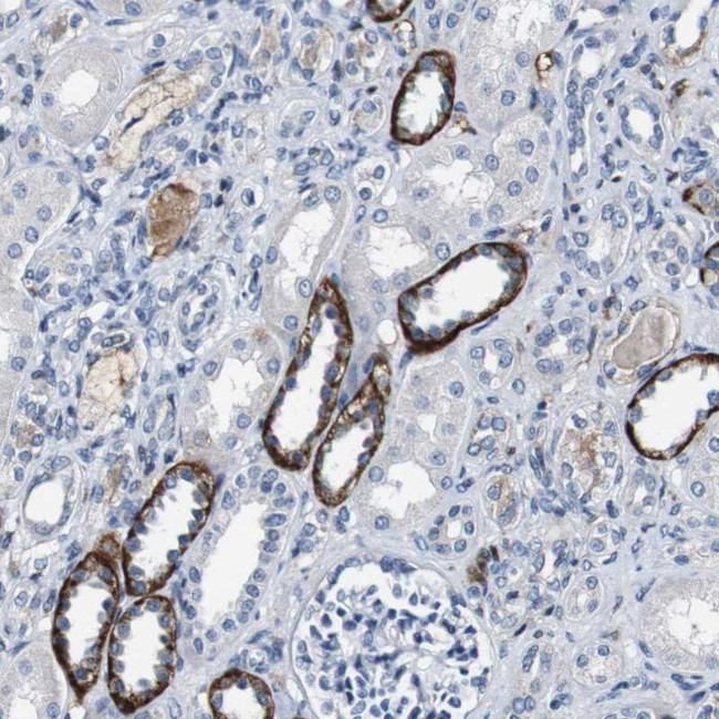 GRAMD1A Antibody in Immunohistochemistry (IHC)