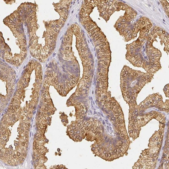 AZGP1 Antibody in Immunohistochemistry (IHC)