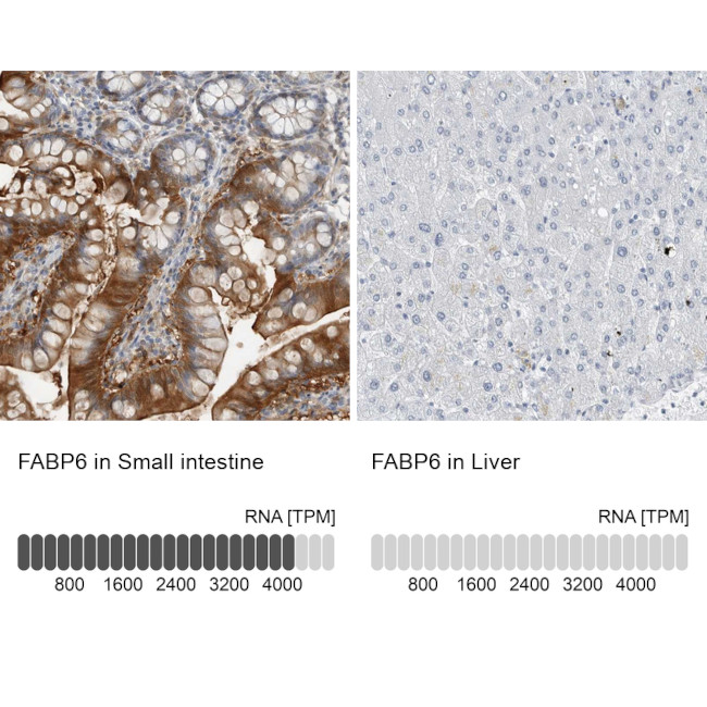 FABP6 Antibody