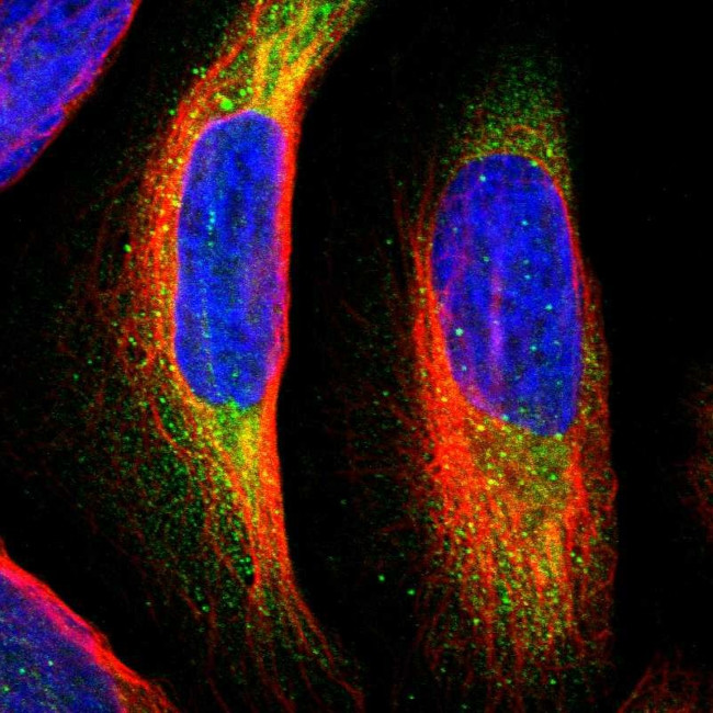 MTH1 Antibody in Immunocytochemistry (ICC/IF)