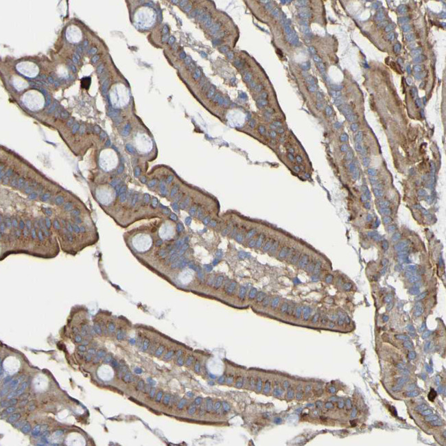 C11orf24 Antibody in Immunohistochemistry (Paraffin) (IHC (P))