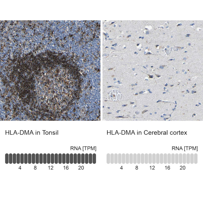 HLA-DMA Antibody in Immunohistochemistry (IHC)