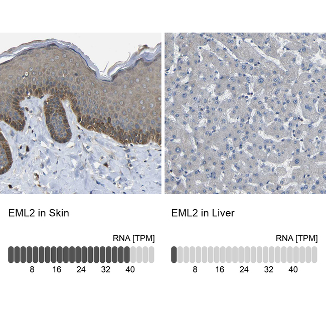EML2 Antibody in Immunohistochemistry (Paraffin) (IHC (P))