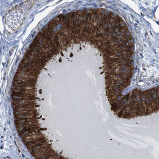 UGGT1 Antibody in Immunohistochemistry (IHC)