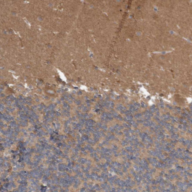 ANKK1 Antibody in Immunohistochemistry (Paraffin) (IHC (P))