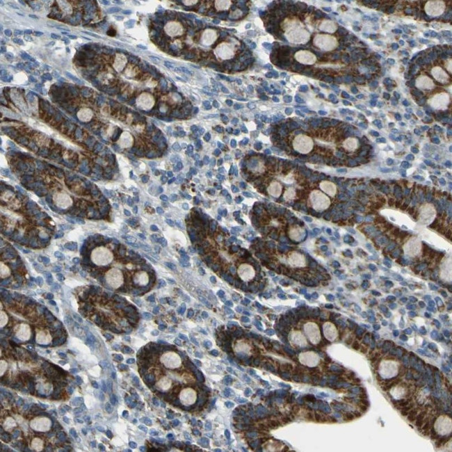 FKTN Antibody in Immunohistochemistry (Paraffin) (IHC (P))