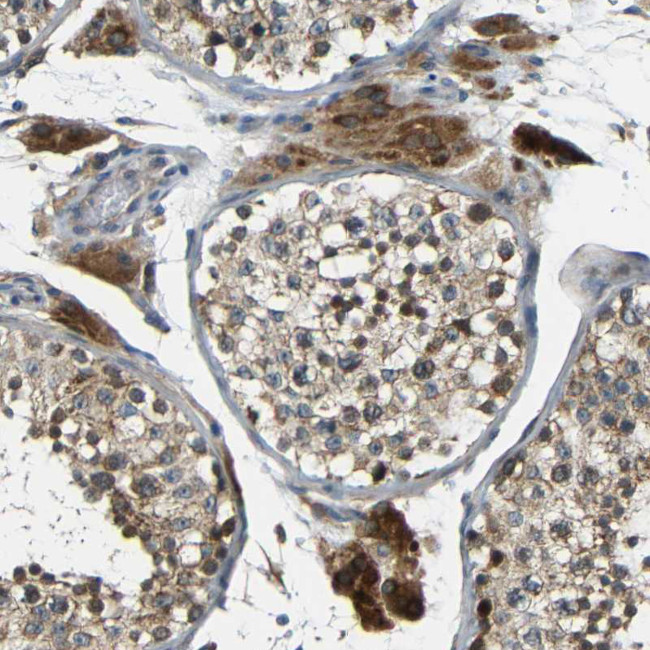 FNDC3A Antibody in Immunohistochemistry (Paraffin) (IHC (P))