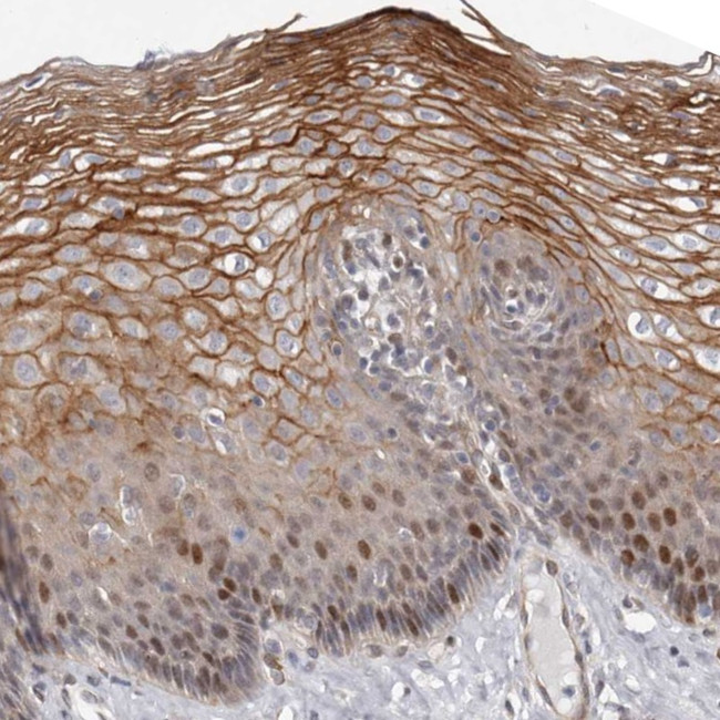 ABHD9 Antibody in Immunohistochemistry (Paraffin) (IHC (P))