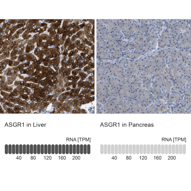 Asgr1 ASGR1 Polyclonal Antibody | Invitrogen (PA5-146064)