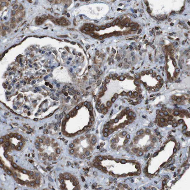 C20orf3 Antibody in Immunohistochemistry (Paraffin) (IHC (P))