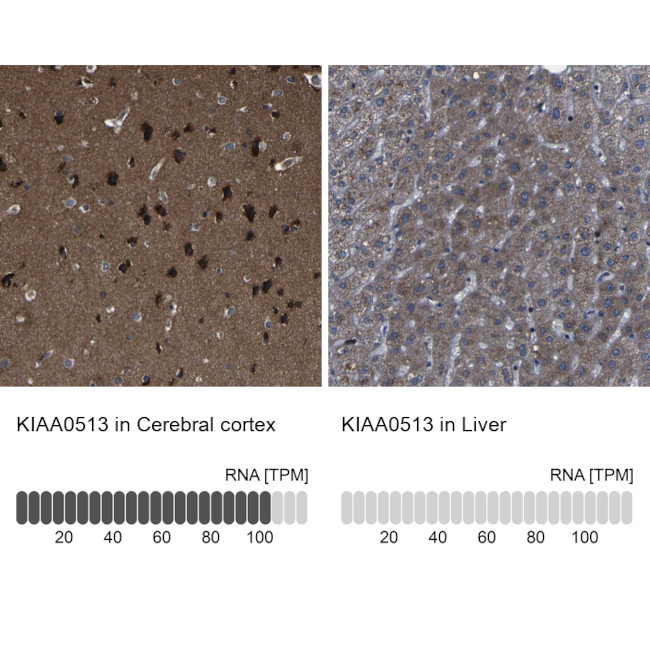 KIAA0513 Antibody in Immunohistochemistry (IHC)