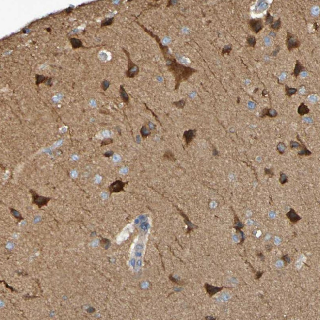 SCRG1 Antibody in Immunohistochemistry (Paraffin) (IHC (P))