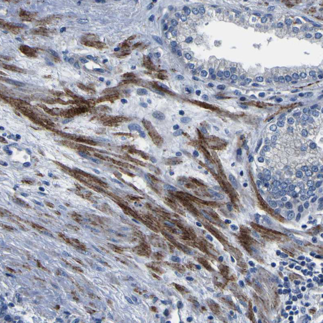 CENTG3 Antibody in Immunohistochemistry (Paraffin) (IHC (P))