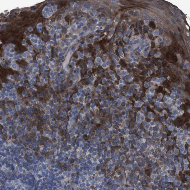 CHST10 Antibody in Immunohistochemistry (Paraffin) (IHC (P))