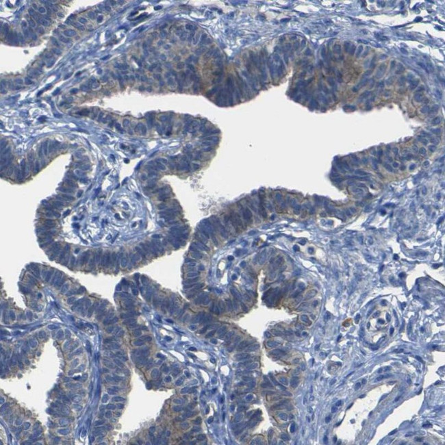 DSC1 Antibody in Immunohistochemistry (IHC)