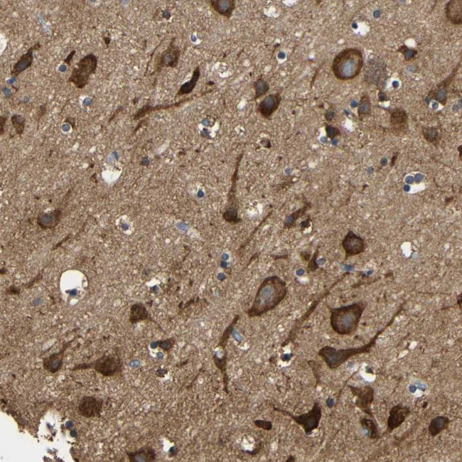 LRRCC1 Antibody in Immunohistochemistry (Paraffin) (IHC (P))