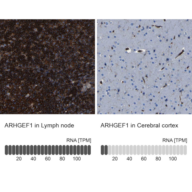ARHGEF1 Antibody in Immunohistochemistry (IHC)
