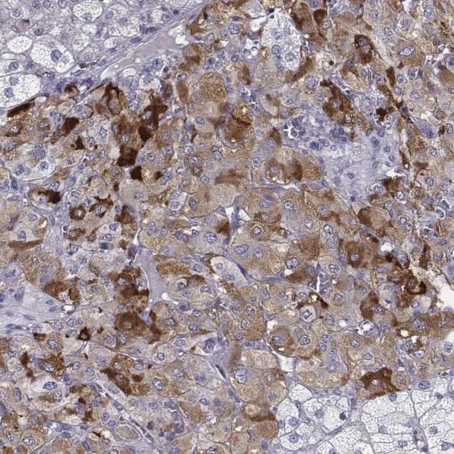 PENK Antibody in Immunohistochemistry (IHC)