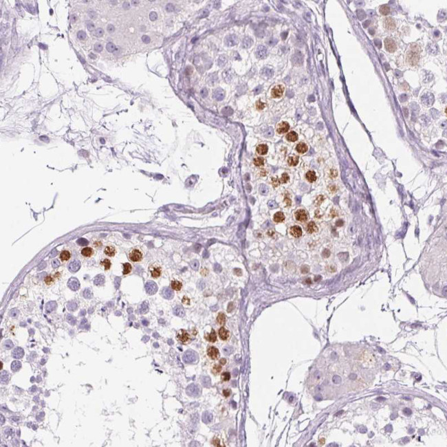 BEND2 Antibody in Immunohistochemistry (Paraffin) (IHC (P))