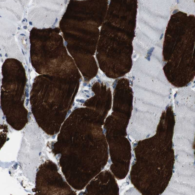 CHRM5 Antibody in Immunohistochemistry (Paraffin) (IHC (P))