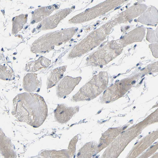 GPR158 Antibody in Immunohistochemistry (Paraffin) (IHC (P))