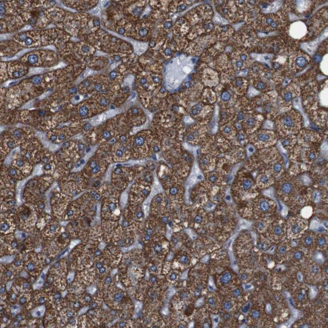 GGT7 Antibody in Immunohistochemistry (Paraffin) (IHC (P))