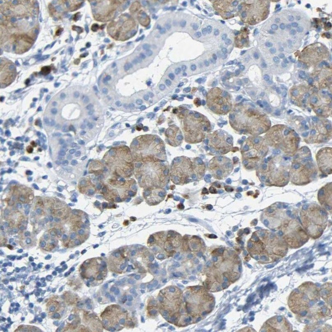 FCRL1 Antibody in Immunohistochemistry (IHC)