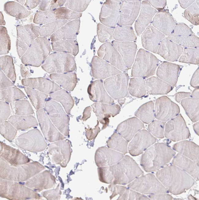 MYL7 Antibody in Immunohistochemistry (Paraffin) (IHC (P))