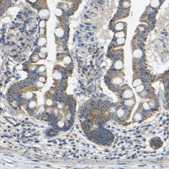 DDX26B Antibody in Immunohistochemistry (IHC)