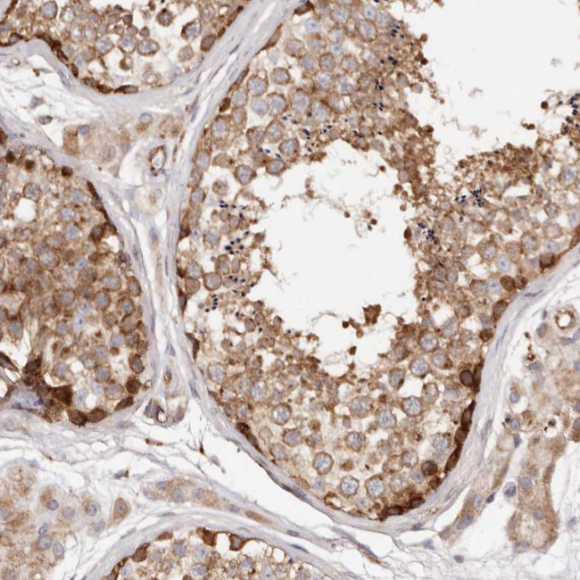 PTPN22 Antibody in Immunohistochemistry (Paraffin) (IHC (P))