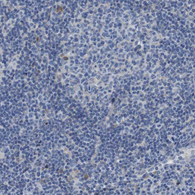 DDRGK1 Antibody in Immunohistochemistry (Paraffin) (IHC (P))