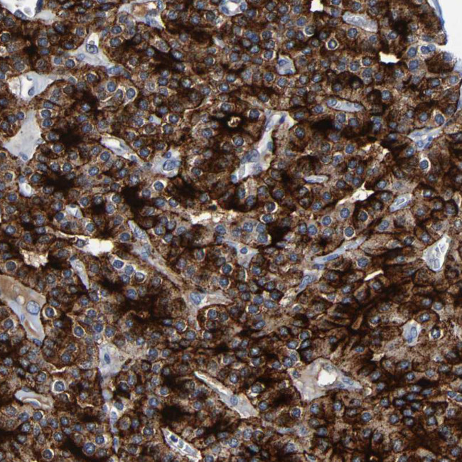 LRRC70 Antibody in Immunohistochemistry (Paraffin) (IHC (P))