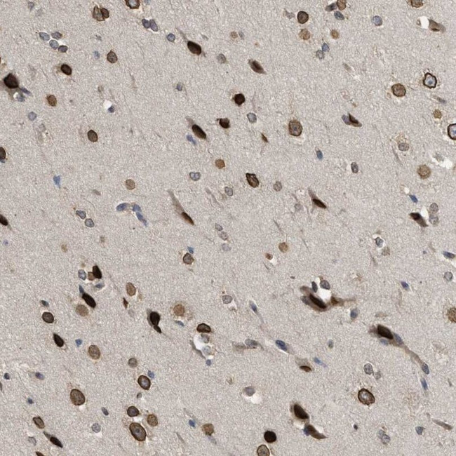 DNAJC1 Antibody in Immunohistochemistry (IHC)