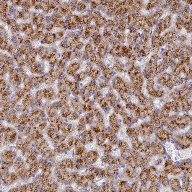 TYW1B Antibody in Immunohistochemistry (Paraffin) (IHC (P))
