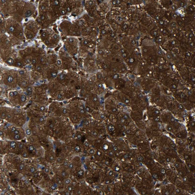 PREB Antibody in Immunohistochemistry (Paraffin) (IHC (P))