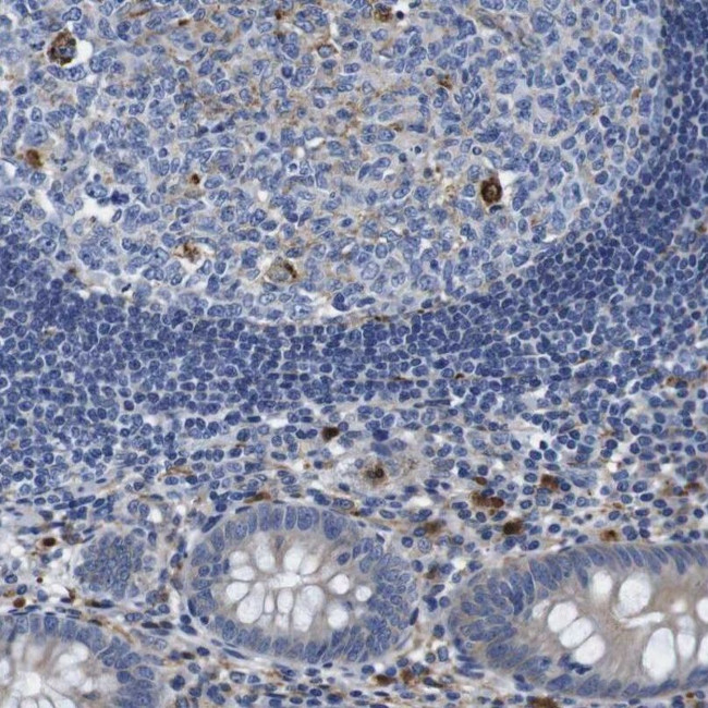GIMAP2 Antibody in Immunohistochemistry (IHC)