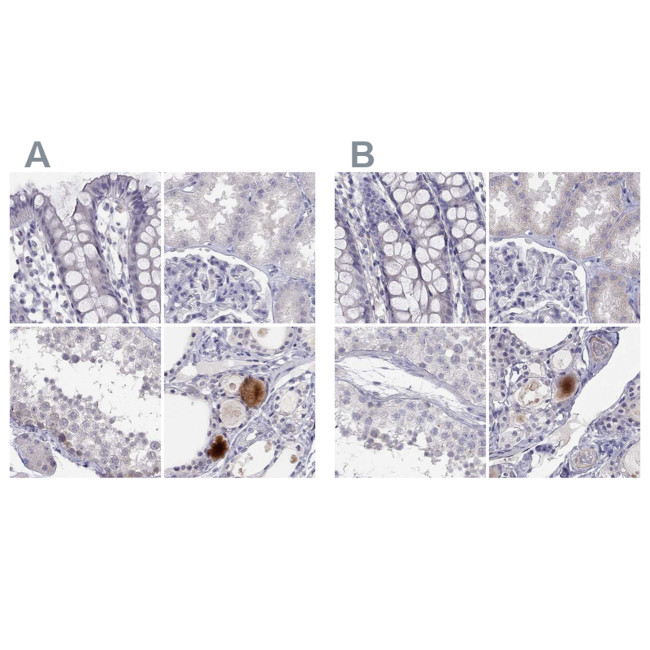 C16orf89 Antibody in Immunohistochemistry (IHC)