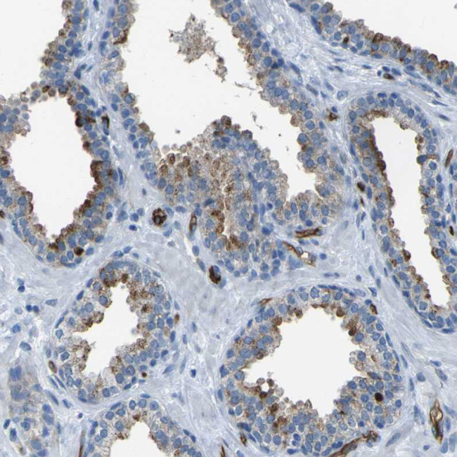 HSPA12B Antibody in Immunohistochemistry (Paraffin) (IHC (P))